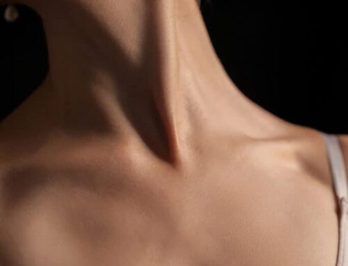Zmarszczki na szyi i dekolcie