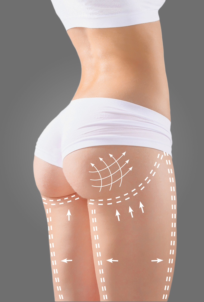 lipo Shock c